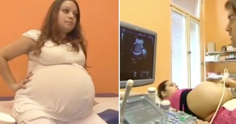 woman pregnant with quintuplets