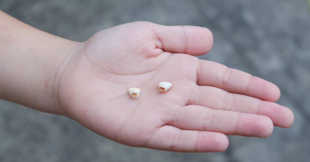 hand holding two baby teeth