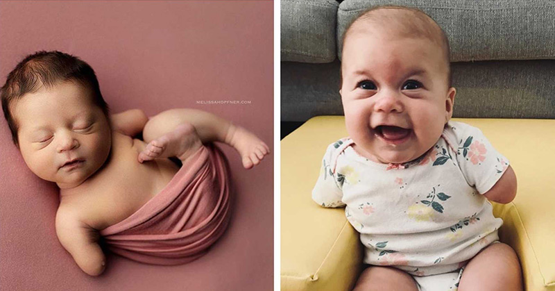 baby girl with no arms