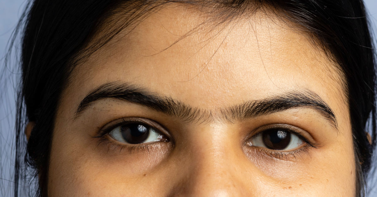 woman with unibrow