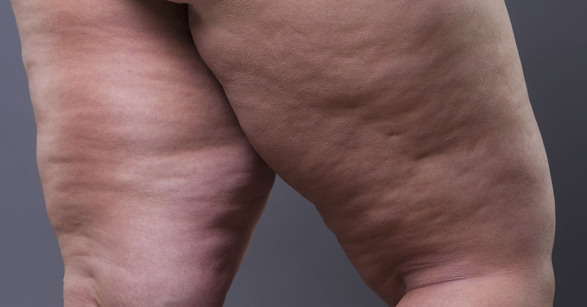 a person's bare legs