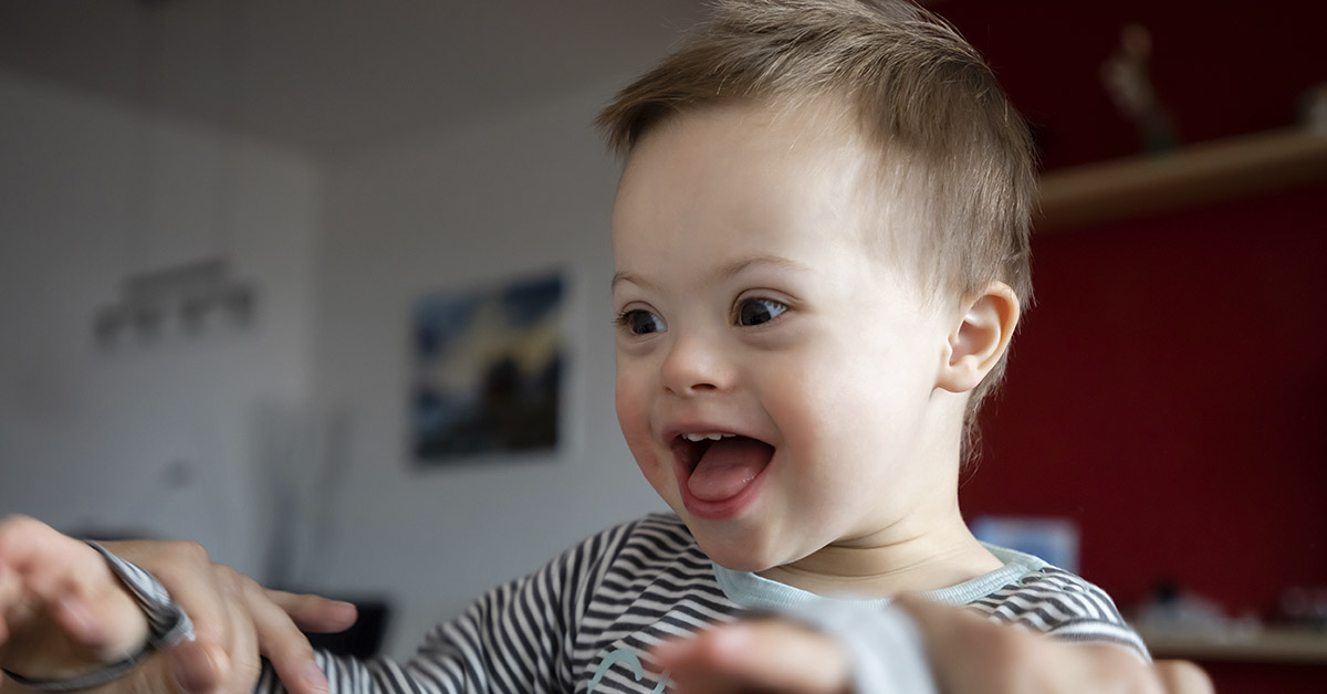 child with Down syndrome