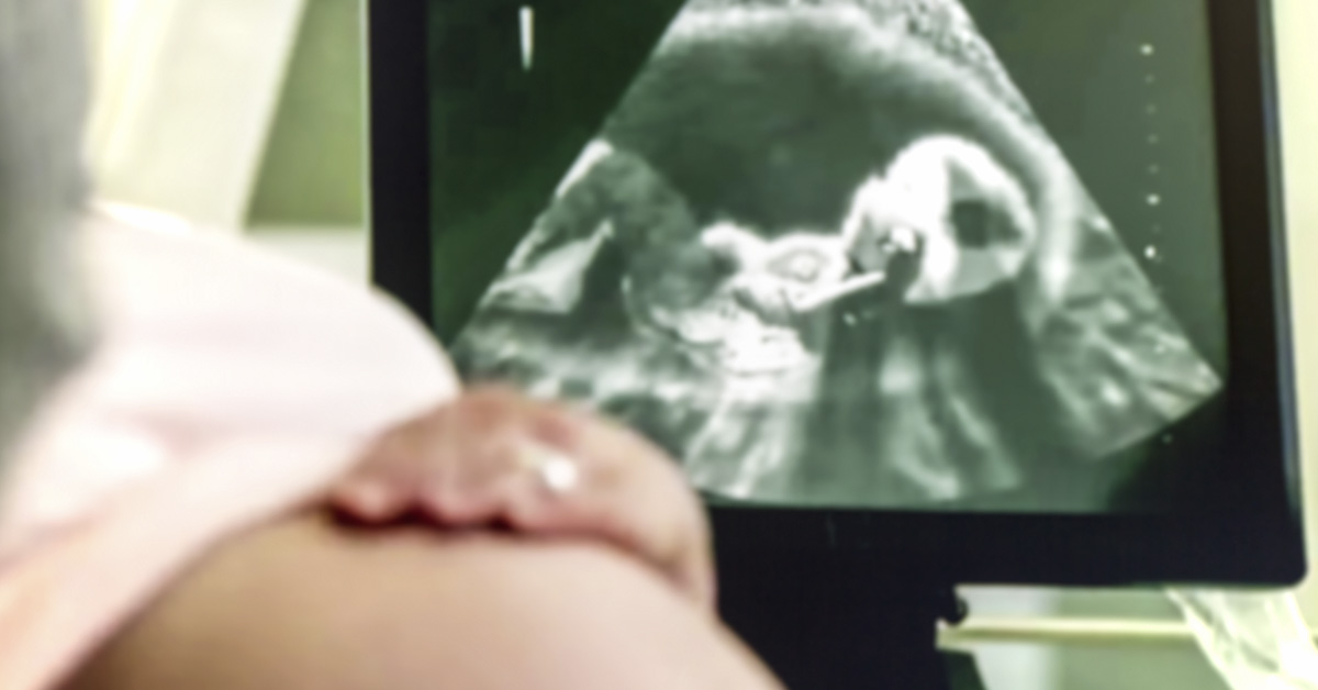 ultrasound