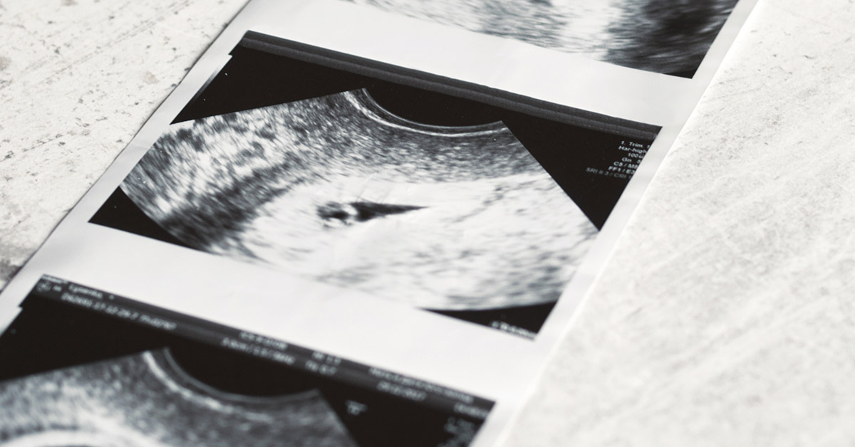 ultrasound image