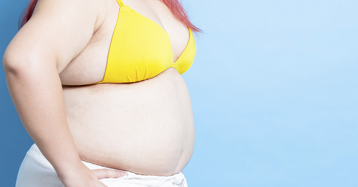woman wearing yellow bikini top and white bottoms. body positivity concept