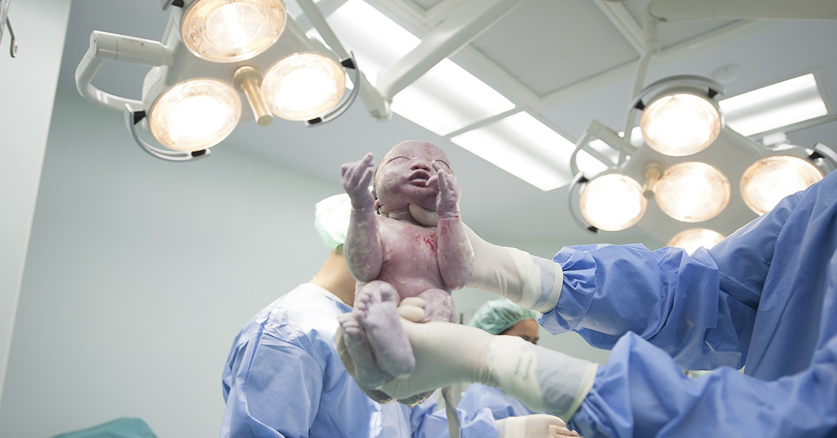 baby being delivered