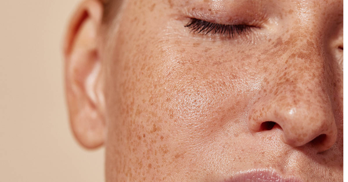 close of person with freckles on face