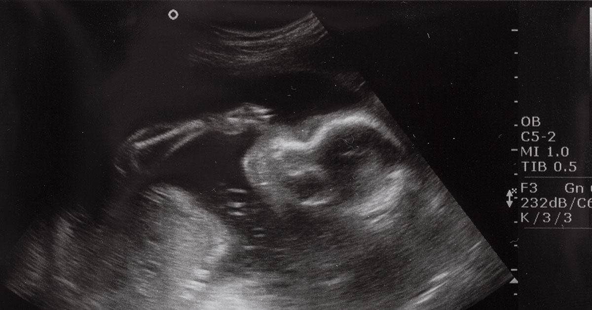 ultrasound