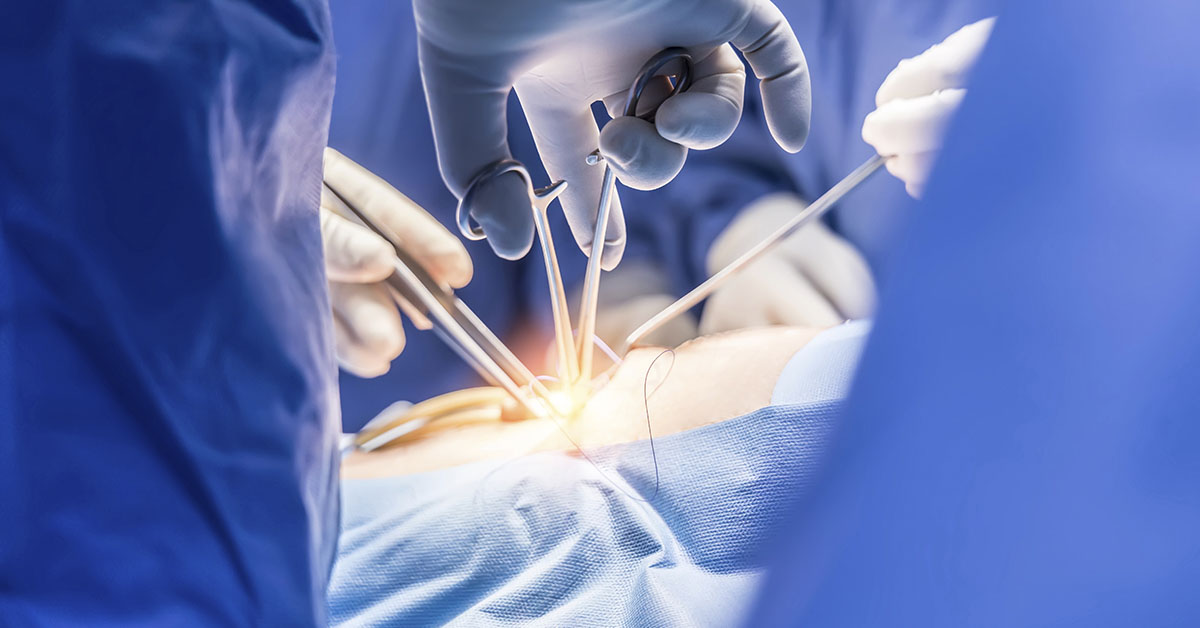 close up of surgeons using tools on patient